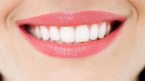 Tẩy trắng răng công nghệ Laser Whitening