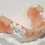 Ba phương pháp trồng răng giả có thể bạn chưa biết