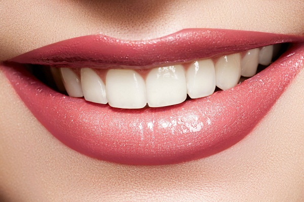 tẩy trắng răng hiệu quả và an toàn tại nhà