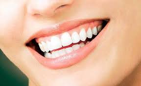 Tại sao nên chọn niềng răng không mắc cài invisalign