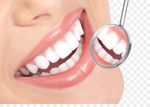 Có nên tẩy trắng răng tại nhà? 3