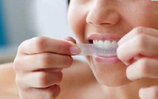 Tác hại của tẩy trắng răng không đúng cách