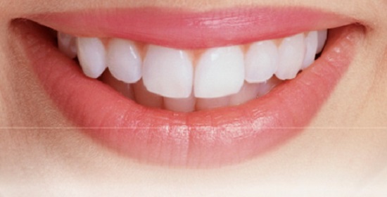 Tẩy trắng răng giá rẻ có tốt không?