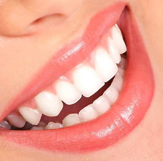 Vì sao nên tẩy trắng răng?