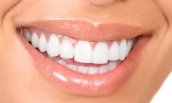 Tẩy trắng răng Brite Smile giá bao nhiêu?
