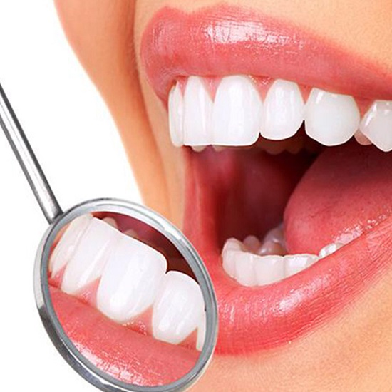 Răng trắng nhanh nhờ công nghệ tẩy trắng răng Laser Whitening