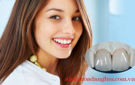 bảng giá răng sứ cao cấp hiện nay