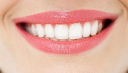 Bọc răng sứ có tốt hay không?