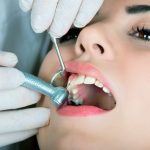Tại sao nên trám răng thẩm mỹ tại nha khoa Đăng Lưu