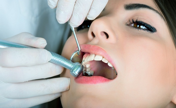 Tại sao nên trám răng thẩm mỹ tại nha khoa Đăng Lưu