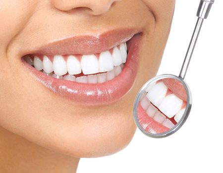 Răng sứ veneer có tốt không?