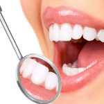 Chi phí trồng răng sứ vĩnh viễn