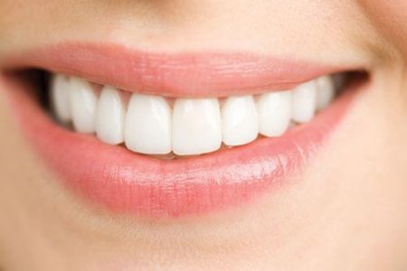 làm răng sứ veneer hiệu quả