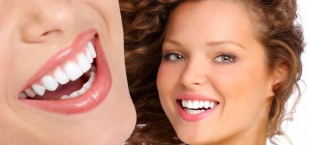 Nên bọc răng sứ hay cấy ghép implant - Tẩy trắng răng giá rẻ tại nhà
