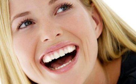chi phí niềng răng cửa bao nhiêu tiền?