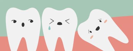Răng khôn gồm bao nhiêu cái?
