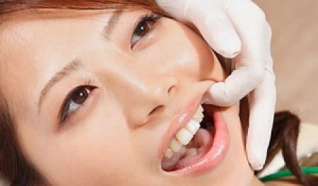 viêm lợi chảy máu chân răng phải làm sao?