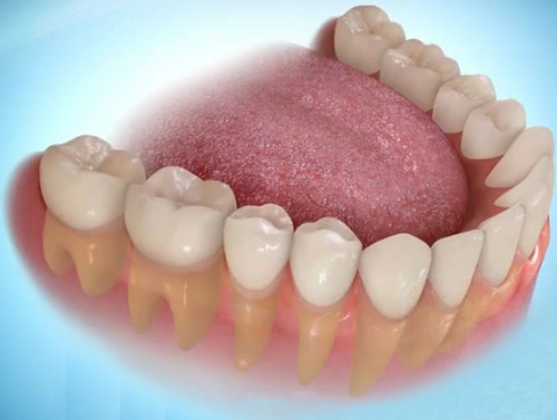 Trồng răng có nhanh không? Giải đáp từ chuyên gia 1