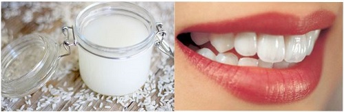Tẩy trắng răng bằng nước gạo có hiệu quả không? 1