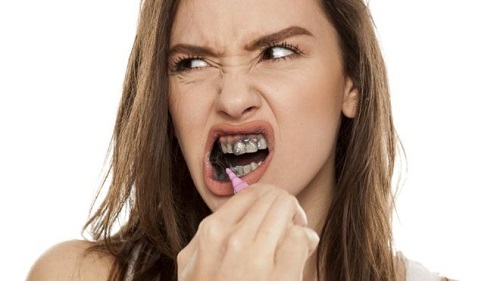 Tẩy trắng răng bằng than hoạt tính có tốt không? 1