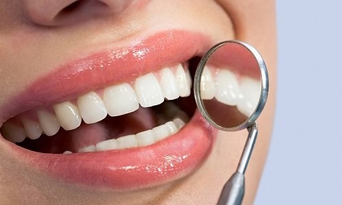 Làm răng sứ thẩm mỹ loại nào tốt nhất hiện nay? 3