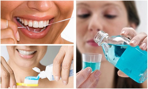 Răng khôn hàm trên bị vỡ - Cách xử lý an toàn 3
