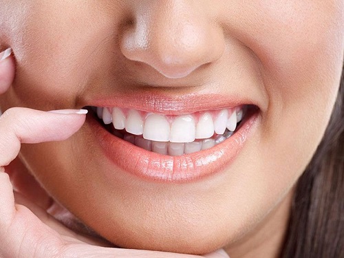 Làm răng sứ mất bao lâu? Tham khảo quy trình thực hiện 2