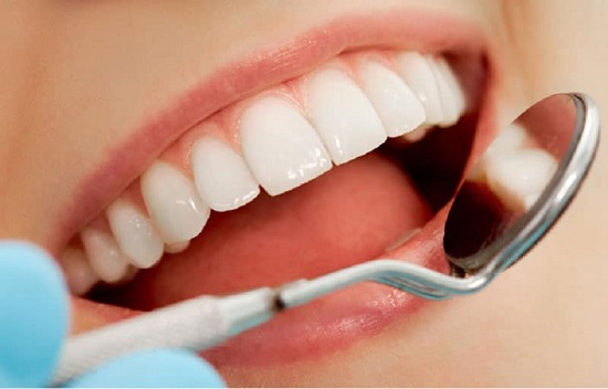 Răng sứ bị thưa khắc phục như thế nào? 2